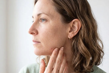 Why Am I Suddenly Getting Acne in My 40s?