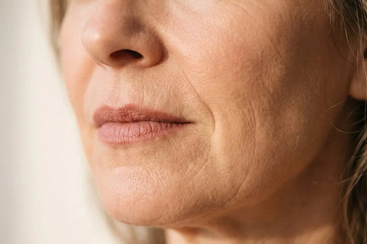 Skin Changes in Perimenopause No One Warns You About