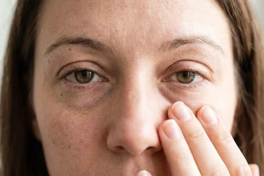 Puffy Eyes Every Morning? Here’s What May Be Causing Them