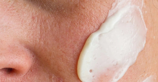 A close up of a woman's cheek showing dry skin with a swipe of Simple Body Face Cream that's a white color on her cheek.