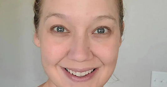 Dehydration-Lines-vs.-Wrinkles Simple Body