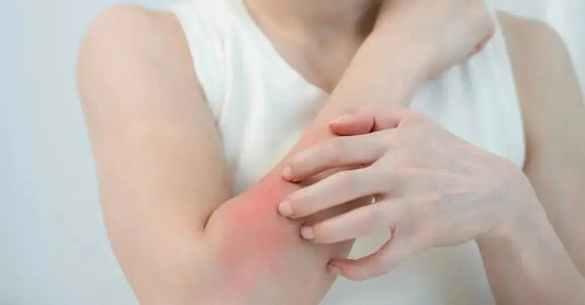 Itchy-Skin-Causes-Relief-and-the-Best-Natural-Skincare-Solutions Simple Body