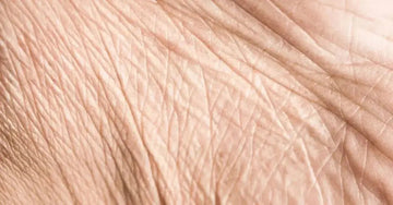 A closeup photo of skin which shows fine lines, wrinkles and crepey skin.
