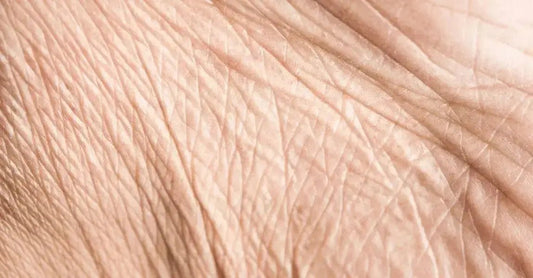 A closeup photo of skin which shows fine lines, wrinkles and crepey skin.