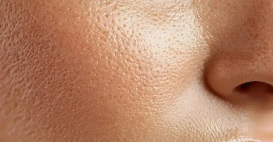 A close up of a woman's cheek that shows large pores, but glowing skin.