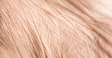 A closeup photo of skin which shows fine lines, wrinkles and crepey skin.