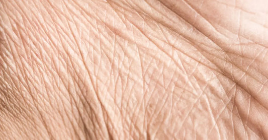 A closeup photo of skin which shows fine lines, wrinkles and crepey skin.