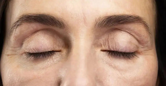 A close up image of a woman with her eyes closed illustrating the difference between wrinkles and no wrinkles around her eye area