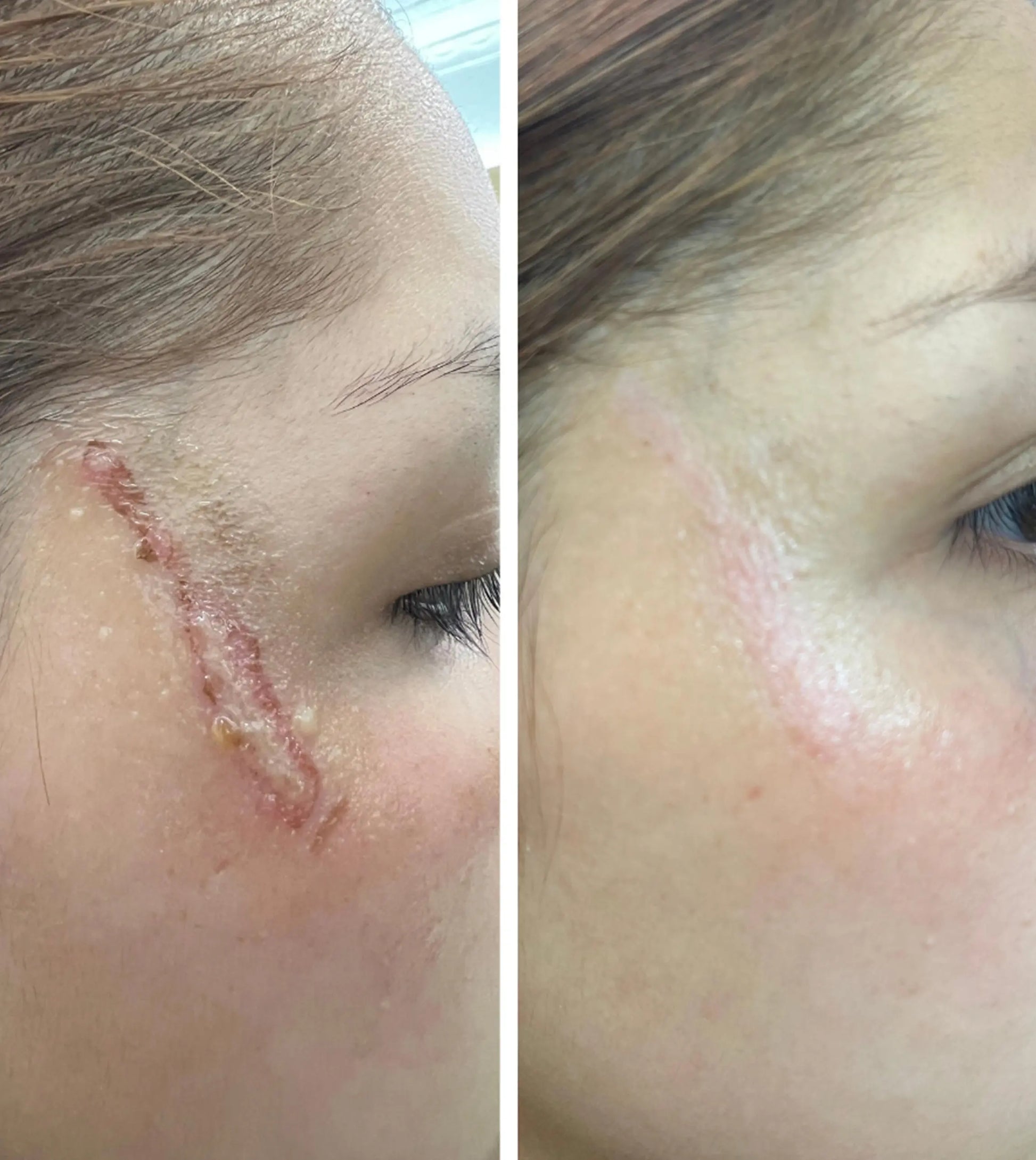 Alondra demonstrating a before and after photo of when she used Simple Body's Herbal Skin Rescue to heal a wound on her skin. The results show amazing recovery after just 4 days. 