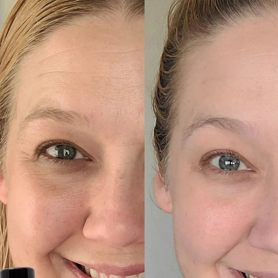 Before and after comparison of a woman's face with a focus on the eye area after using Simple Body Eye Defense Serum