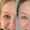 Before and after comparison of a woman's face with a focus on the eye area after using Simple Body Eye Defense Serum