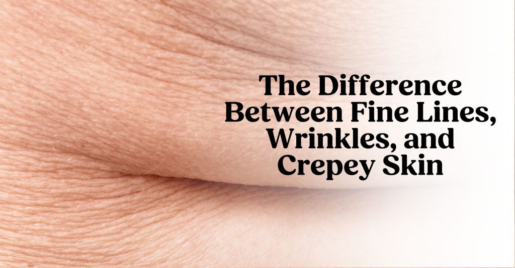 A close up image of crepey, wrinkles skin